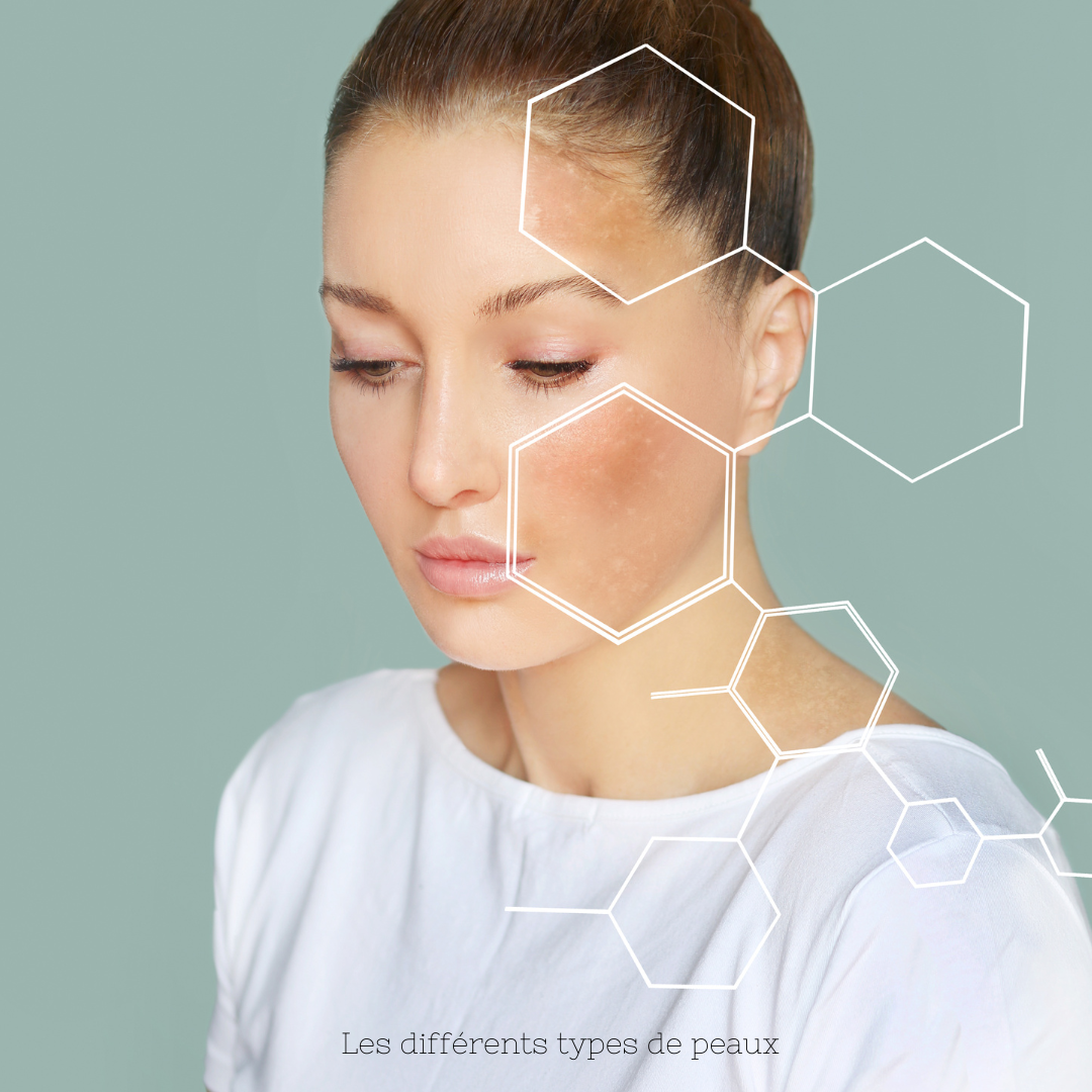 les différents types de peaux